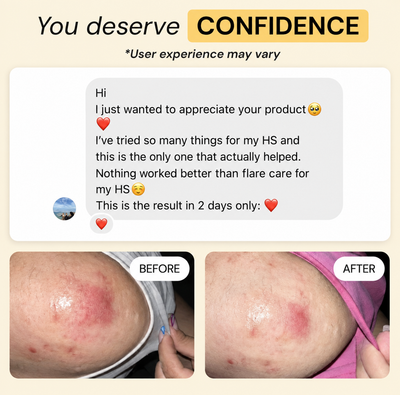Vivella Universal Flare Care