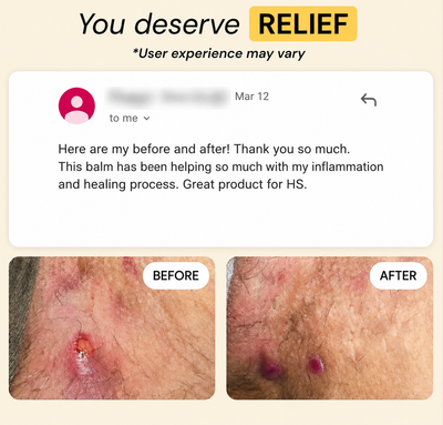 Vivella Universal Flare Care