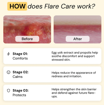 Vivella Universal Flare Care