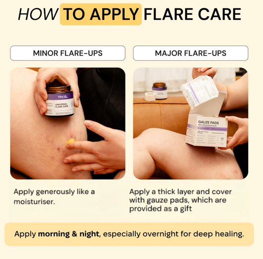 Vivella Universal Flare Care