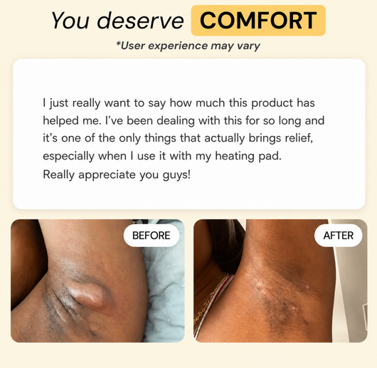 Vivella Universal Flare Care